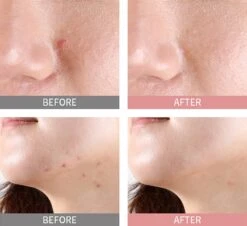 Mizon Good Bye Blemish Pink Spot -Brown Technies Magasin mizon good bye blemish pink spot serum local avec poudre anti acne 3