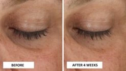 Perricone MD Cold Plasma Plus+ Eye -Brown Technies Magasin perricone md cold plasma plus eye creme nourrissante yeux anti poches et anti cernes 4