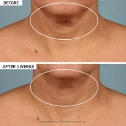 StriVectin Tighten & Lift TL Advanced Tightening Neck Cream Plus -Brown Technies Magasin strivectin tighten lift tl advanced tightening neck cream plus creme liftante raffermissante cou et decollete 3